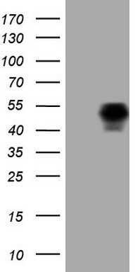 PARP1 Antibody