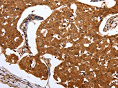 PARP1 Antibody