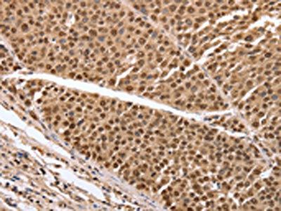 PARP1 Antibody