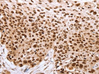 PARP1 Antibody