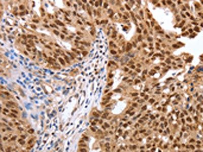 PARP1 antibody