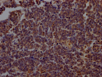 PARP1 Antibody