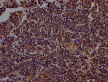 PARP1 antibody