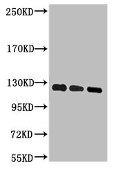 PARP1 Monoclonal Antibody