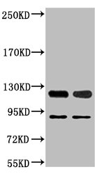 PARP1 Monoclonal Antibody