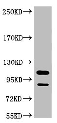 PARP1 Monoclonal Antibody