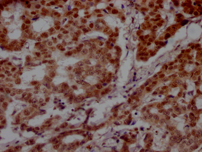 PARP1 Recombinant Monoclonal Antibody