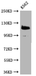 PARP1 Recombinant Monoclonal Antibody