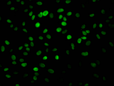 PARP1 Recombinant Monoclonal Antibody