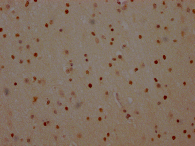 PARP1 Recombinant Monoclonal Antibody