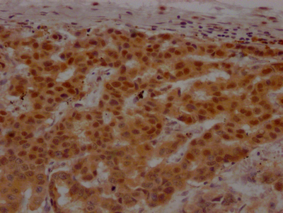 PARP1 Recombinant Monoclonal Antibody