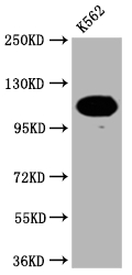 PARP1 antibody