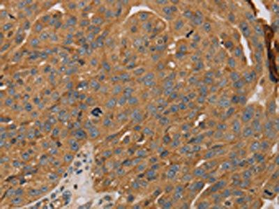 PARP11 Antibody