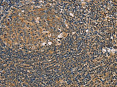 PARP11 Antibody