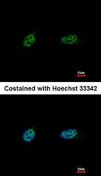 PARP3 Rabbit Polyclonal Antibody