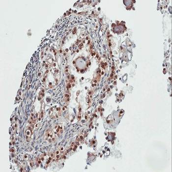 PARP3 Rabbit Polyclonal Antibody