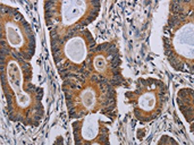 PARP8 Antibody