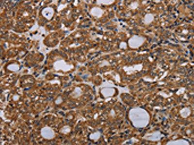 PARP8 Antibody