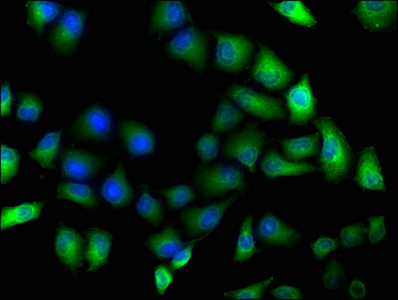 PARP8 Antibody