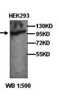 PARP Rabbit Polyclonal Antibody