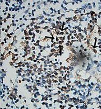 PARP Rabbit Polyclonal Antibody