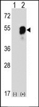 PARS2 antibody