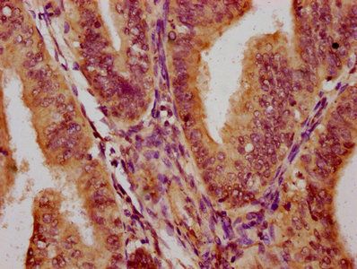 PARS2 Antibody
