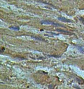 PARS2 Rabbit Polyclonal Antibody