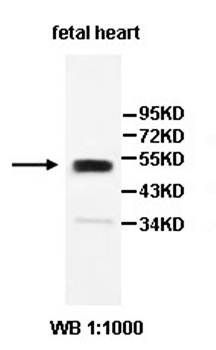 PARS2 Rabbit Polyclonal Antibody