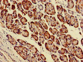 PARVA Antibody