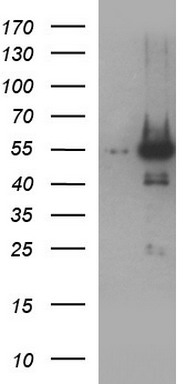 PARVB Antibody