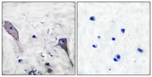 Patched Antibody