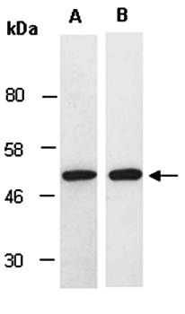 PAX2 (M) Antibody, Rabbit Polyclonal