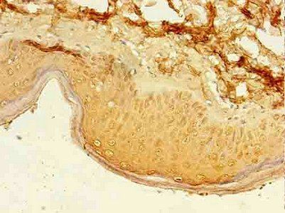 PAX3 Antibody