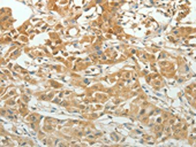 PAX5 Antibody