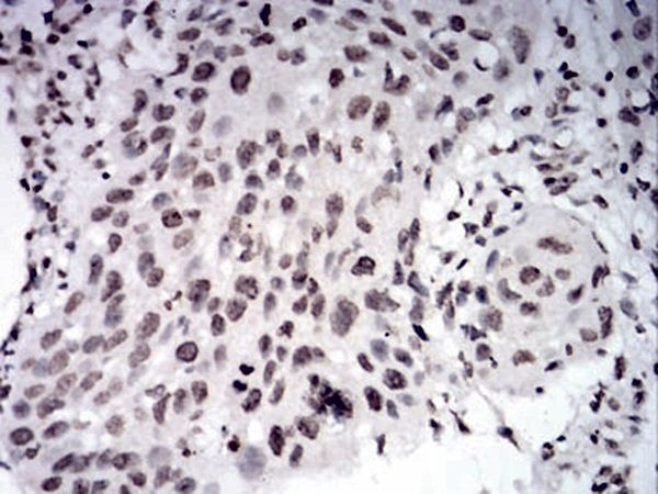 PAX6 Antibody