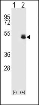PAX6-T373 antibody