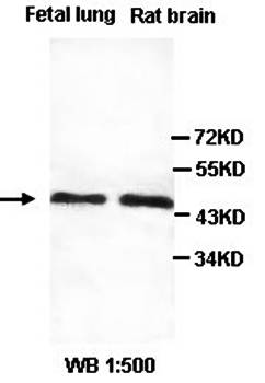 PAX6 Rabbit Polyclonal Antibody