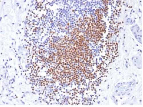 PAX8 (Renal Cell Marker) Antibody
