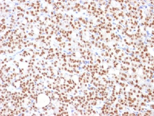 PAX8 (Renal Cell Marker) Antibody
