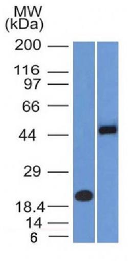 PAX8 antibody