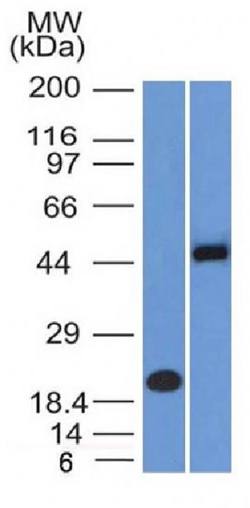 PAX8 (Renal Cell Marker) Antibody