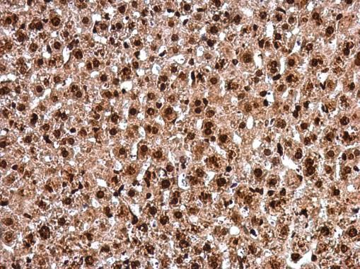 PAX8 antibody