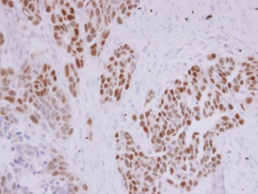 paired box 8 Antibody