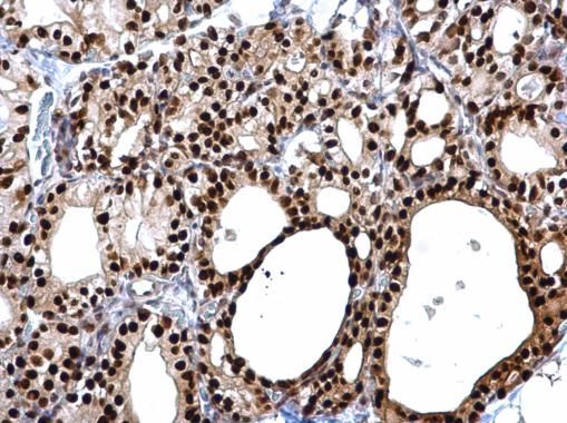 PAX8 antibody