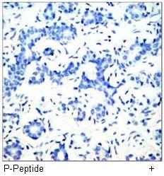 Paxillin (Phospho-Tyr118) Antibody