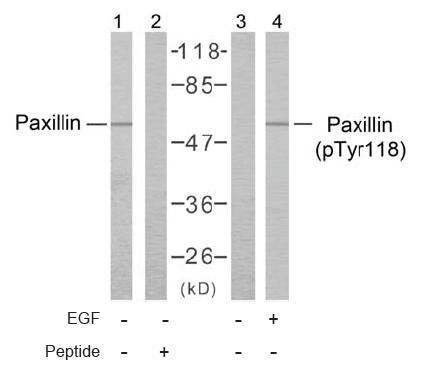 Paxillin (Phospho-Tyr118) Antibody