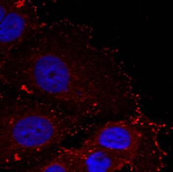 Paxillin (phospho-Tyr88) Antibody