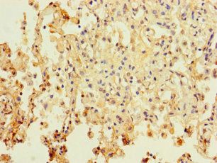 PAXIP1 Antibody