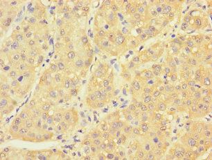 PCBD1 Antibody